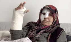 Erzurum'da sahipsiz köpeklerin saldırısında merdivenden düşen kadının kolu ve burnu kırıldı